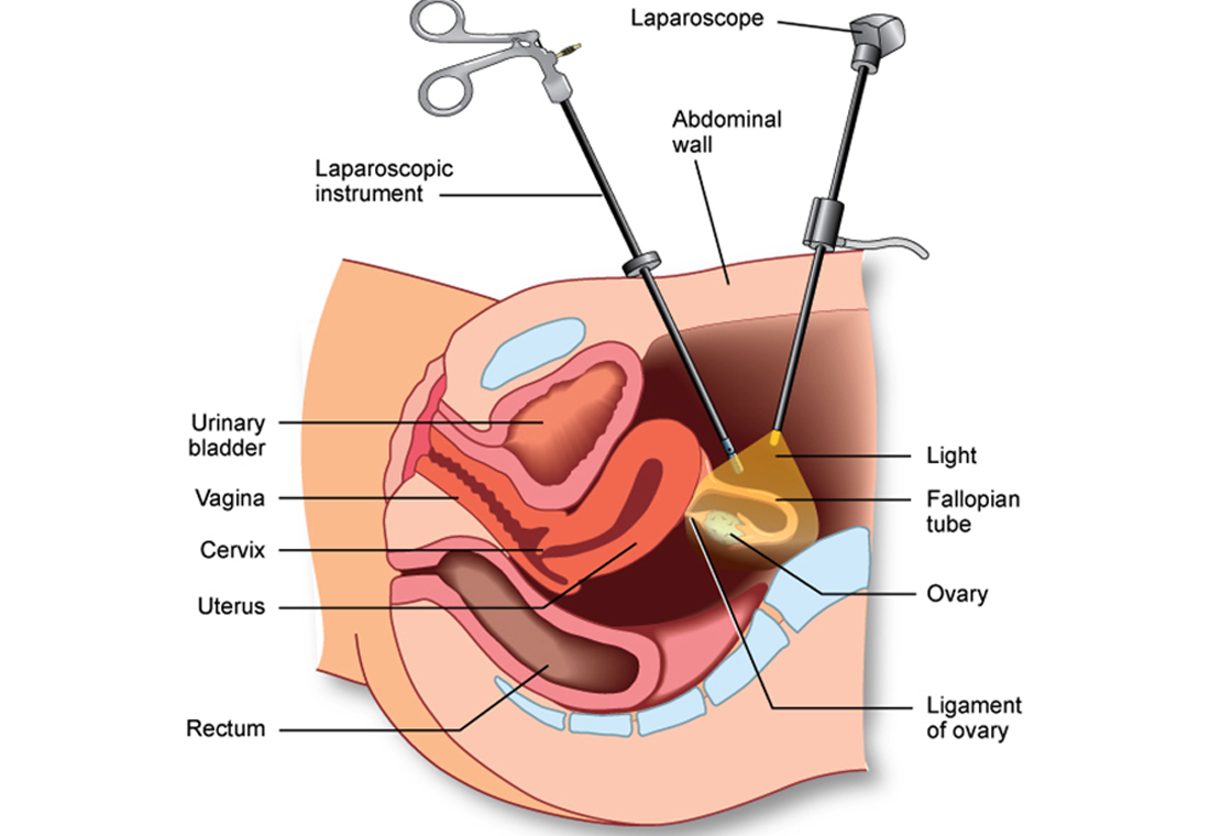 Lap & Robotic GI Surgery