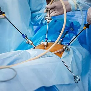 Gallbladder Cancer Surgery